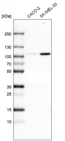 Anti-SOX6, clone CL5685