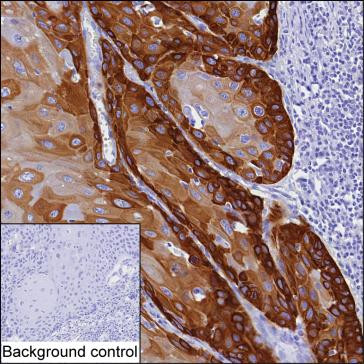 Anti-Cytokeratin-15