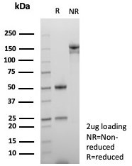 Anti-NUTM1 / NUT family member 1, clone SNUPN/7363R