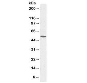 Anti-Alanine aminotransferase 1