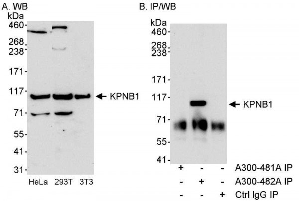 Anti-KPNB1