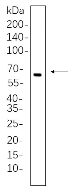 Anti-Recombinant Estrogen Receptor alpha, clone 6H7
