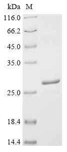 Fusion glycoprotein F0 (F), partial, human metapneumovirus, recombinant