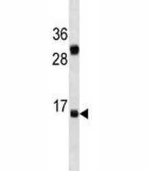 Anti-IL-2, clone 627CT14.8.1