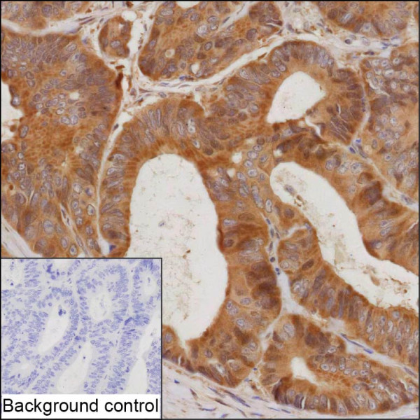 Anti-SIRT2 Recombinant