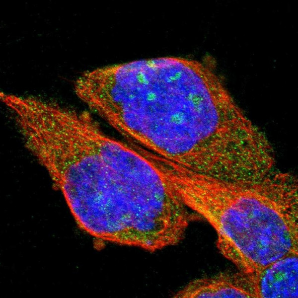 Anti-PPM1B