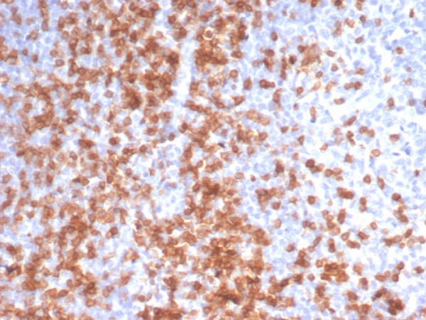 Anti-CD3e (T-Cell Marker), recombinant antibody, clone C3e/3125R
