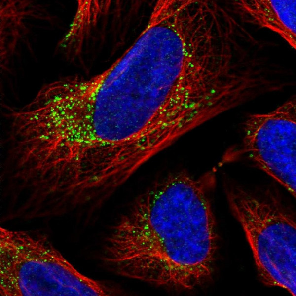 Anti-INPP1