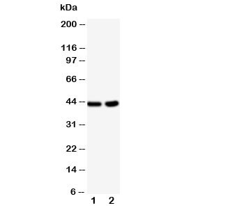 Anti-BCAT1