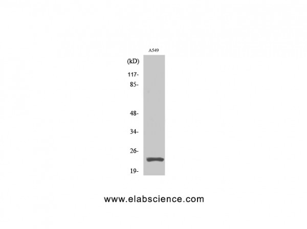 Anti-Cleaved-PARP-1 (D214)