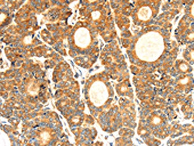 Anti-CYP7A1