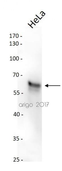 Anti-Smad2, clone 6H5-E3-C11