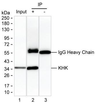 Anti-KHK