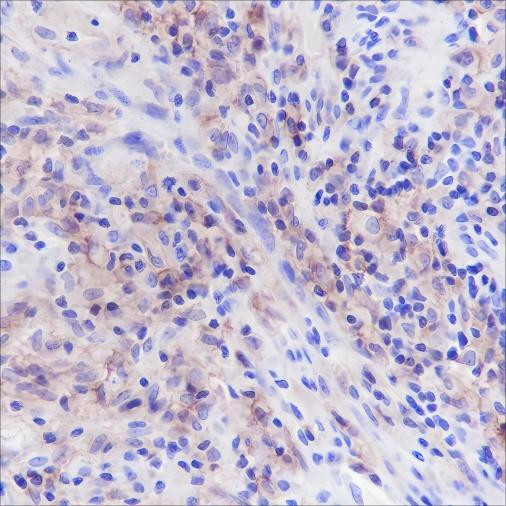 Anti-Recombinant CD33, clone A170