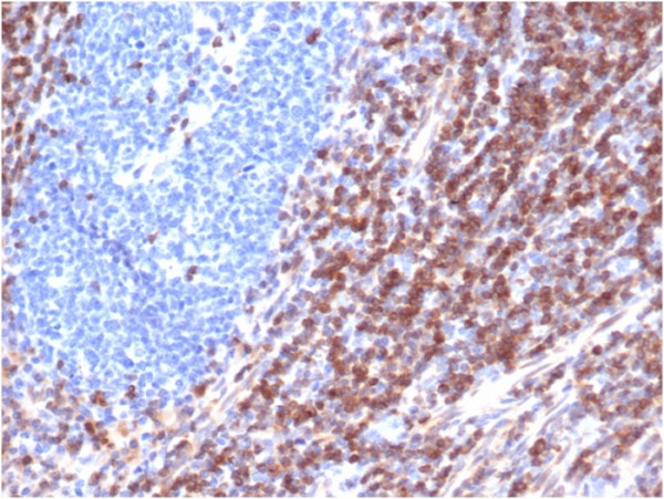 Anti-Bcl-2 (Apoptosis&amp; Follicular Lymphoma Marker), recombinant antibody, clone rBCL2/6418