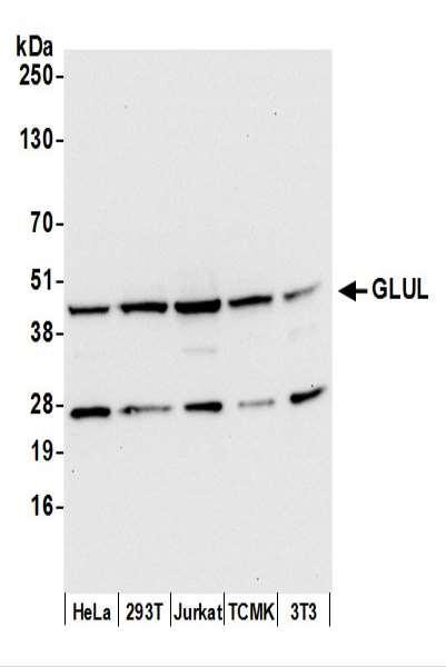 Anti-GLUL/Glutamine Synthetase