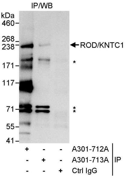 Anti-ROD/KNTC1