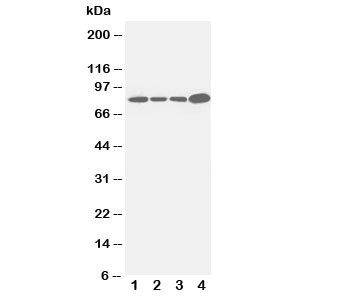 Anti-Integrin beta 3