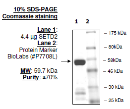 SETD2, Active human recombinant protein, N-terminal GST-tag