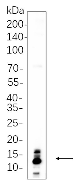 Anti-Recombinant S100B, clone 4F6