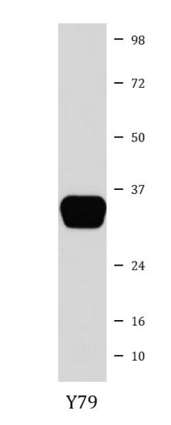 Anti-Otx1 + Otx2