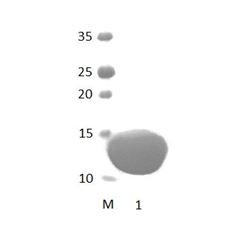 PARD3B_3 PDZ Domain