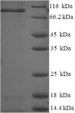 Caprin-1 (Caprin1), rat, recombinant