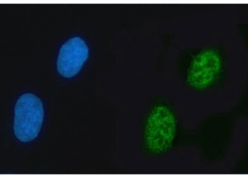 Anti-ZNF609 / KIAA0295