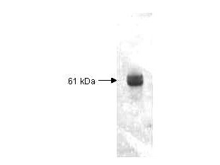 Anti-Carboxypeptidase Y (baker's yeast)