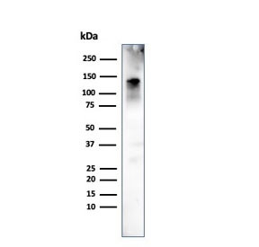 Anti-Caldesmon / CAD HMW, clone h-CALD