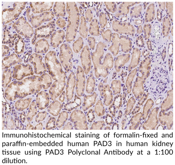 Anti-PAD3