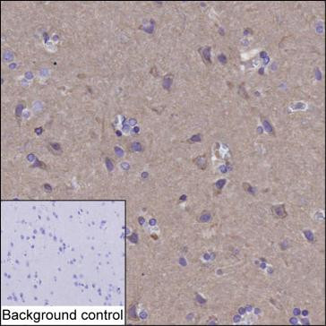 Anti-HMGCR
