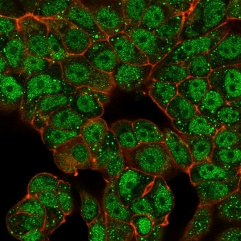 Anti-CTBP2 / C-terminal-binding protein 2, clone PCRP-CTBP2-2D11