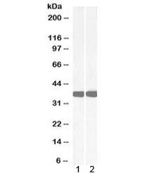 Anti-Arginase