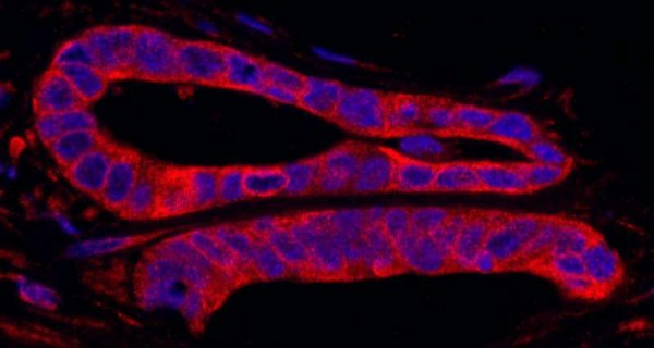 Anti-SRPK2 (IHC)