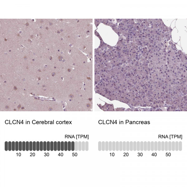Anti-CLCN4