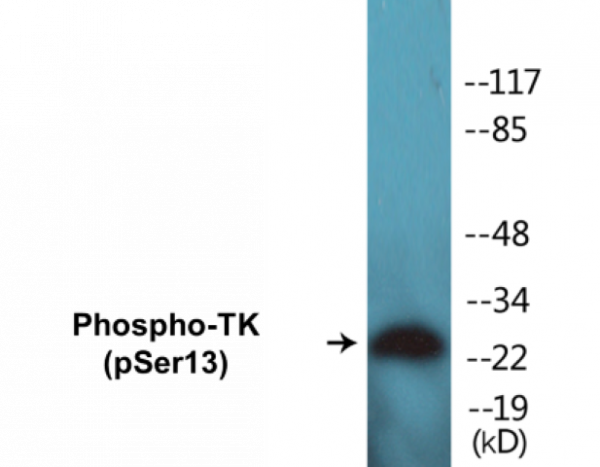 TK (Phospho-Ser13) Colorimetric Cell-Based ELISA Kit