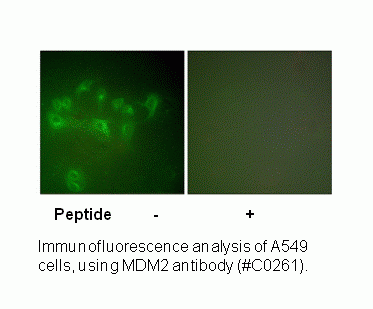 Anti-MDM2