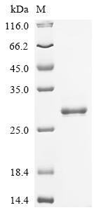 Ras-related protein Rab-5C (RAB5C), recombinant human