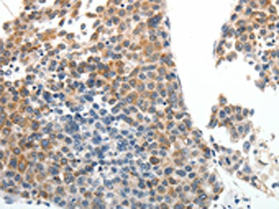 Anti-ABCG5