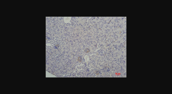 Anti-TBP/TATA Binding Protein, monoclonal