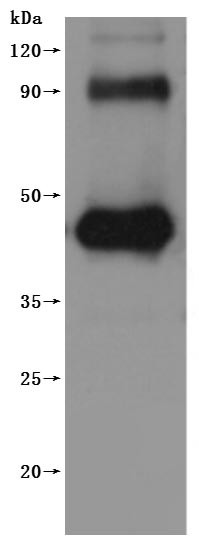 G-protein coupled receptor family C group 5 member D (GPRC5D)-VLPs (Active), human, recombinant