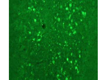 Anti-Calretinin