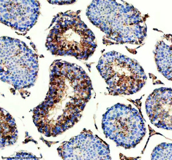 Anti-IQCM / IQ motif-containing protein M