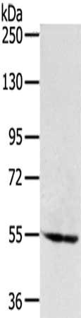 Anti-SNX1