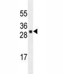Anti-UBTD1, clone 189CT14.5.4
