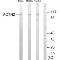 Anti-ACTN2/ACTN3