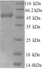 Heterogeneous nuclear ribonucleoprotein Q (SYNCRIP), partial, human, recombinant