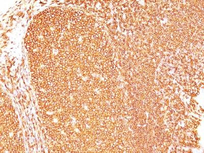 Anti-CD45RB (B-Cell Marker)(Clone: PD7/26)