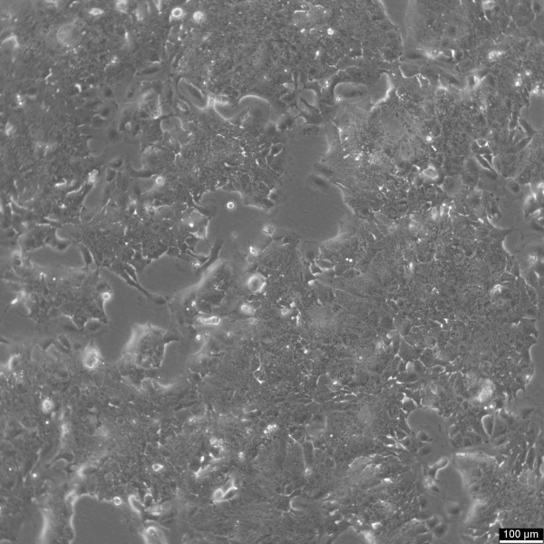 NCI-H2170 Cells